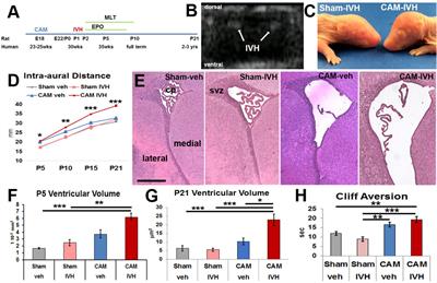 Extended Combined Neonatal Treatment With Erythropoietin Plus Melatonin Prevents Posthemorrhagic Hydrocephalus of Prematurity in Rats